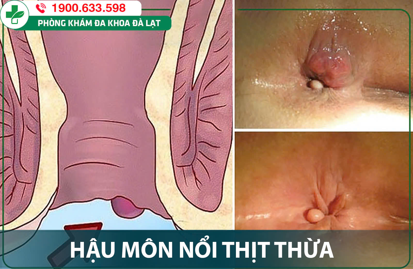 Hình ảnh minh họa